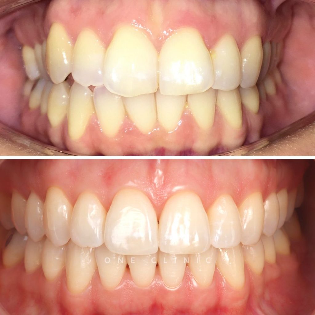 Ortodontia - Caso 1